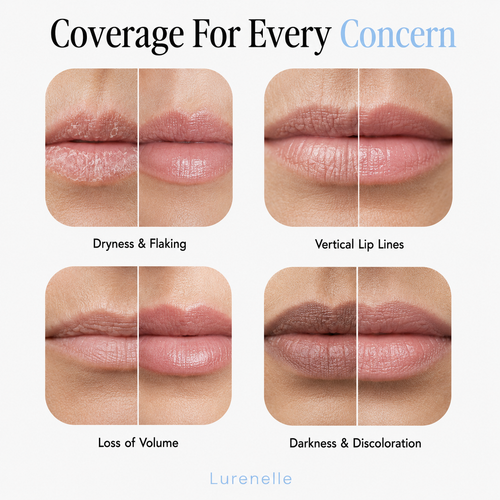 Lurenelle's Lip Mask